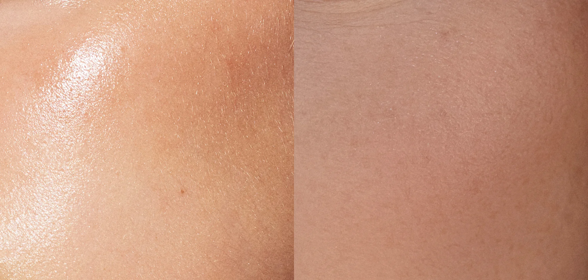 Glass skin vs. Cloud skin